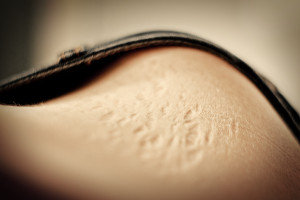 The Postpartum Stomach