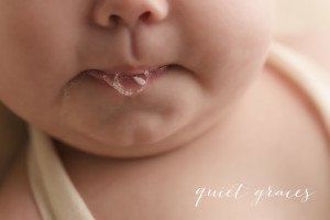 Special needs baby picture miracle