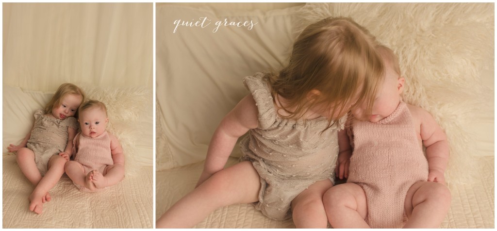 Babies with Down Syndrome