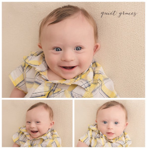 What it is like to have a child with Down Syndrome