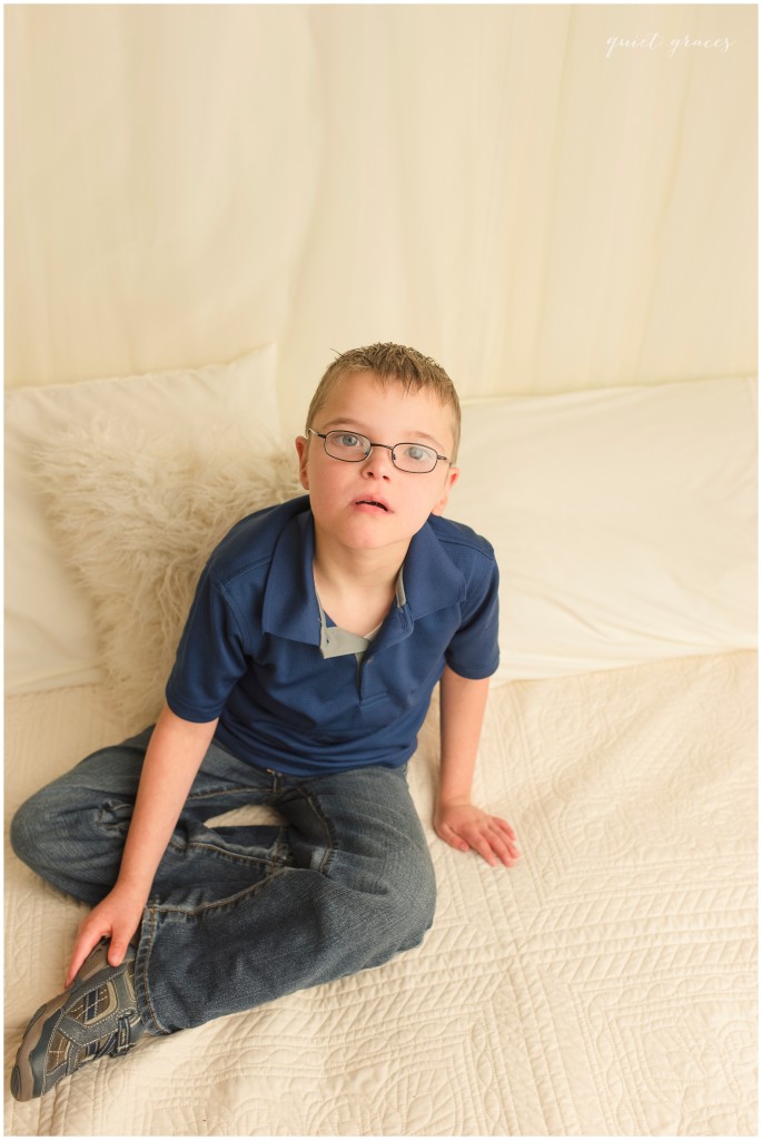 Down Syndrome