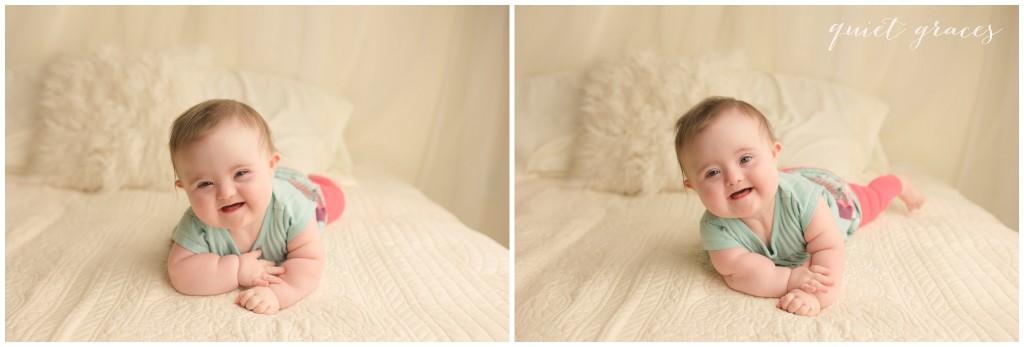 What it's really like to have a child with Down Syndrome