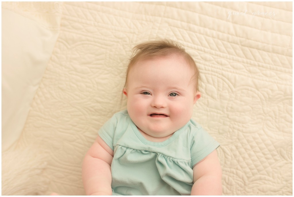 Down Syndrome Greenville SC