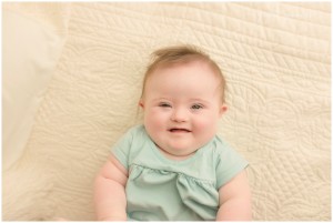 Down Syndrome Greenville SC