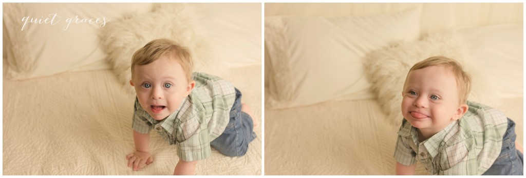 Baby with Down Syndrome