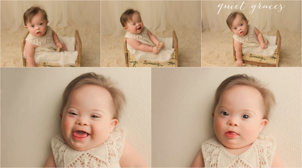 Diagnosis of Down Syndrome