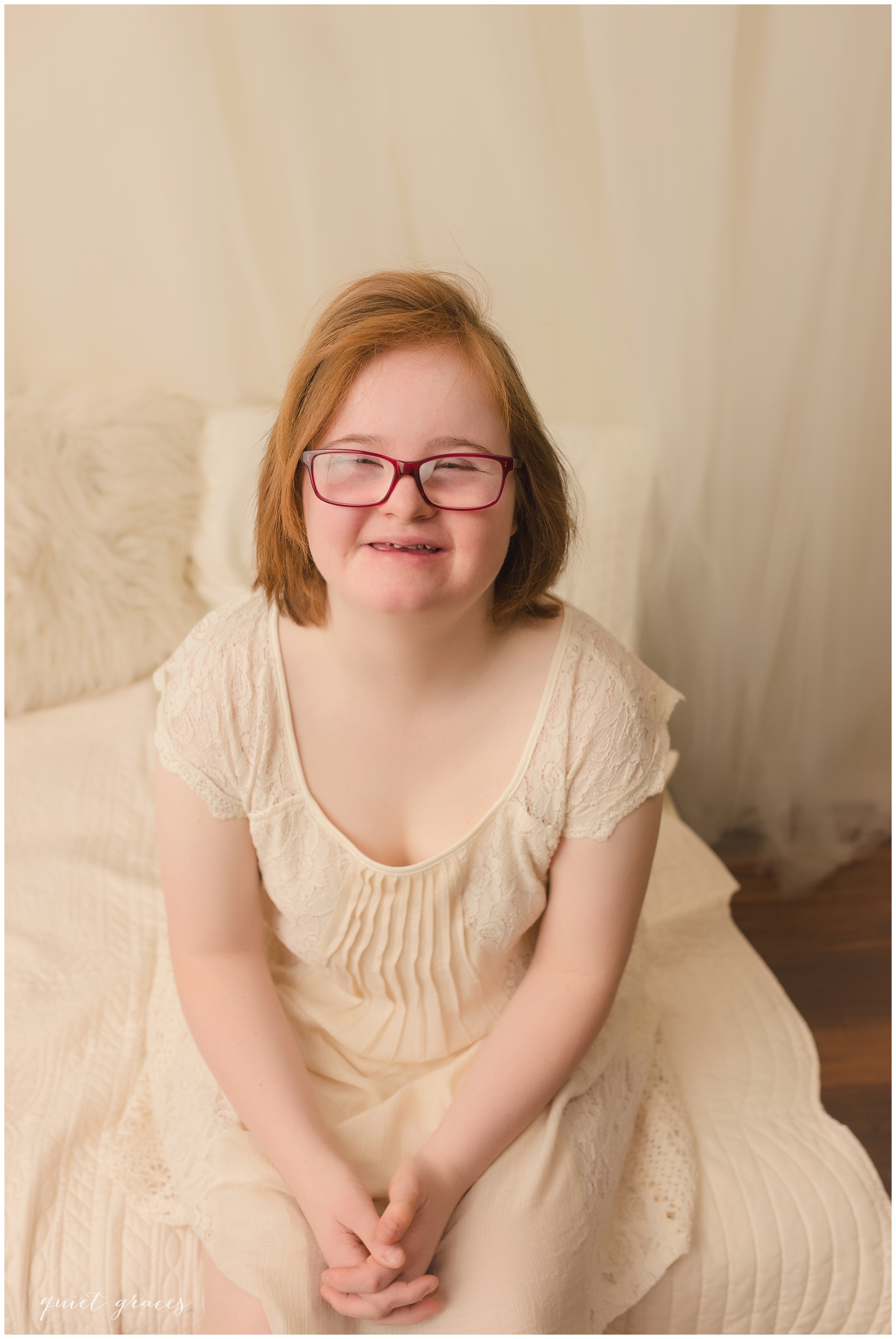 Young Adult with Down Syndrome.